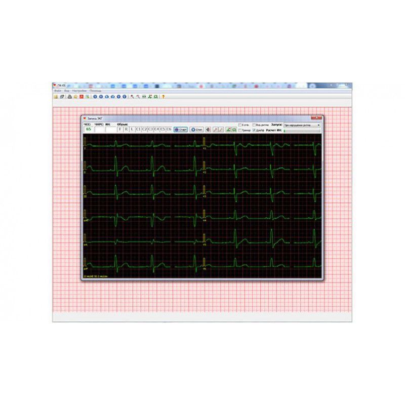 Нпп монитор. Кардиорегистратор портативный КРП-01. Купить монитор к кардиорегистратору.